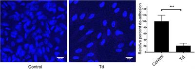 Treponema denticola-Induced RASA4 Upregulation Mediates Cytoskeletal Dysfunction and MMP-2 Activity in Periodontal Fibroblasts